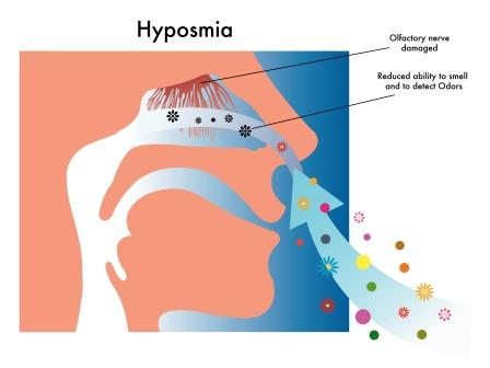 Anosmia: Ayurvedic Treatment And Home Remedies